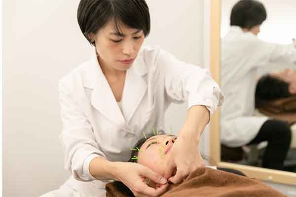 患者様の顔に鍼を打っている様子